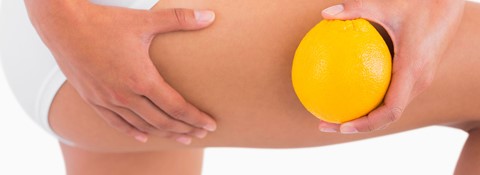 Che cos’è la cellulite: stadi, tipi e cause